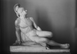Figur: Verwundeter Achill